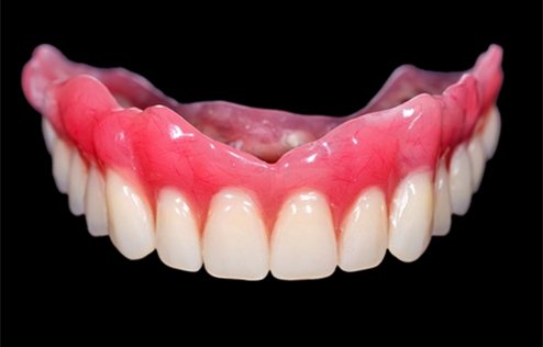 complete-dentures